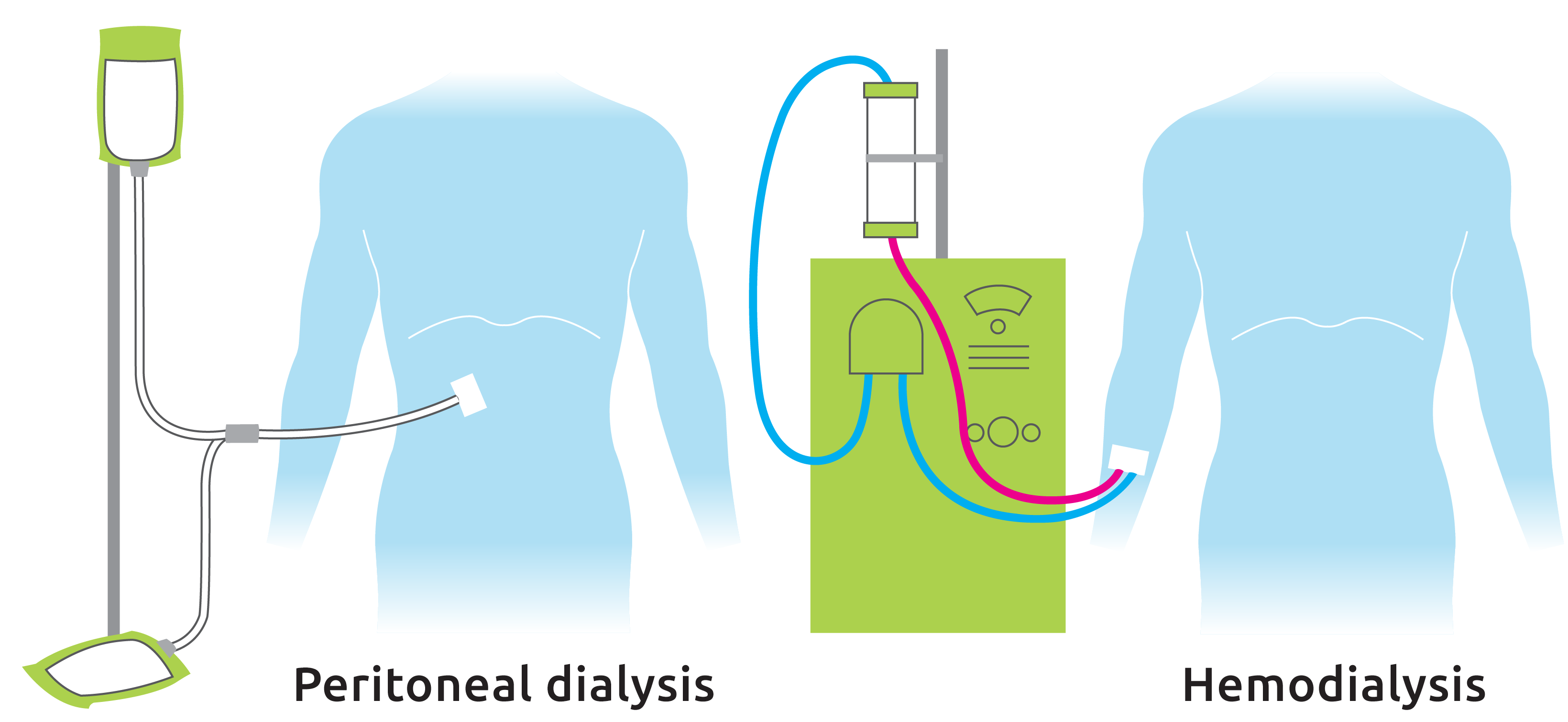 Diagram Of Dialysis